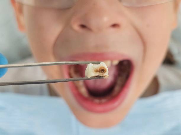 Best Emergency Treatment for Oral Infections in Wren, AR